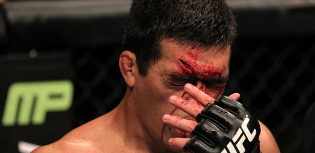 Lyoto Machida sofreu um corte profundo na luta contra Jon Jones