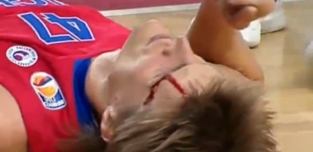 Andrei Kirilenko sofreu fratura no nariz e corte no rosto ao bater a cabeça no chão - Reprodução