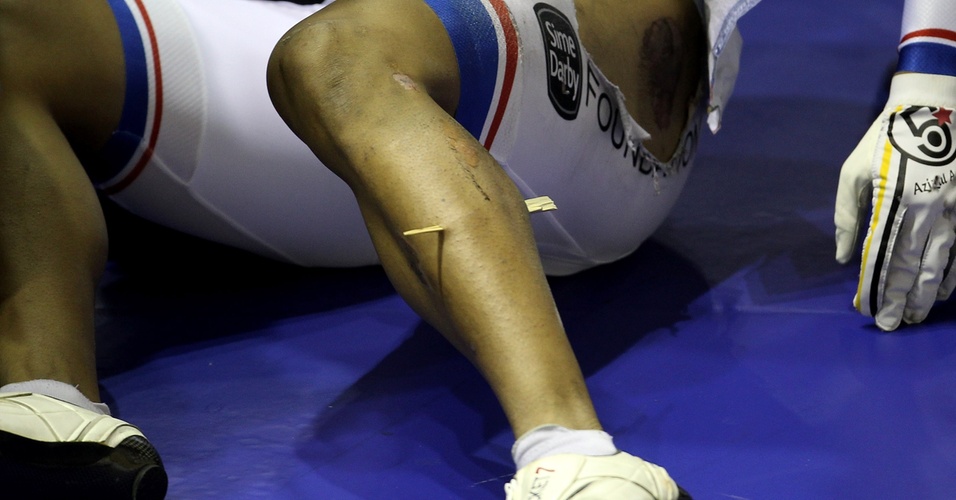 Detalhe do pedaço de madeira preso na panturrilha do ciclista malaio Azizulhasni Awang