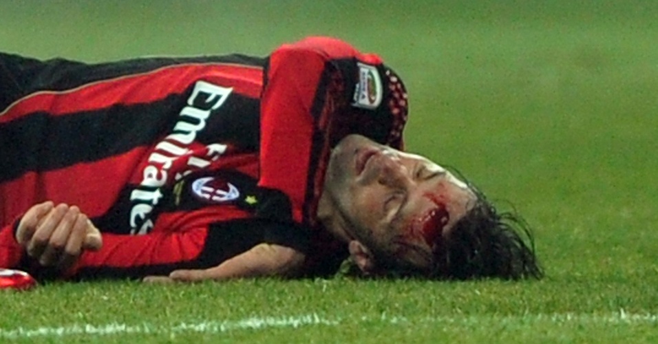 Após choque, Legrottaglie sangra no empate do Milan com a Lazio