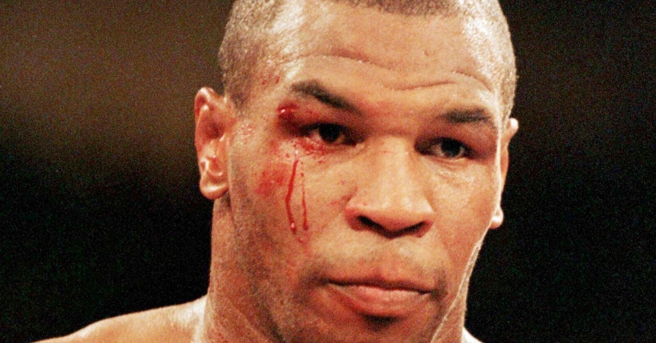 Mike Tyson sangra após uma cabeçada na luta contra Evander Holyfield (28/06/1997)
