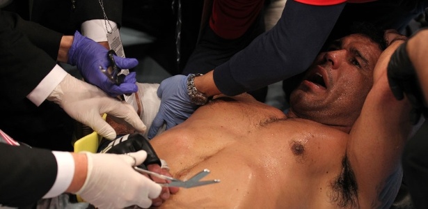 Minotauro recebe tratamento logo após ser finalizado por Frank Mir e fraturar o úmero - Getty Images/UFC