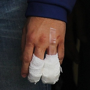 Jorge Lorenzo decepa parte do dedo após sofrer acidente durante aquecimento para GP da Austrália  - Daniel Munoz/Reuters